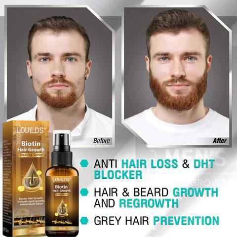 1+1 Kostenlos|LushLocks™ – Für dichteres, kräftigeres Haar in nur wenigen Wochen