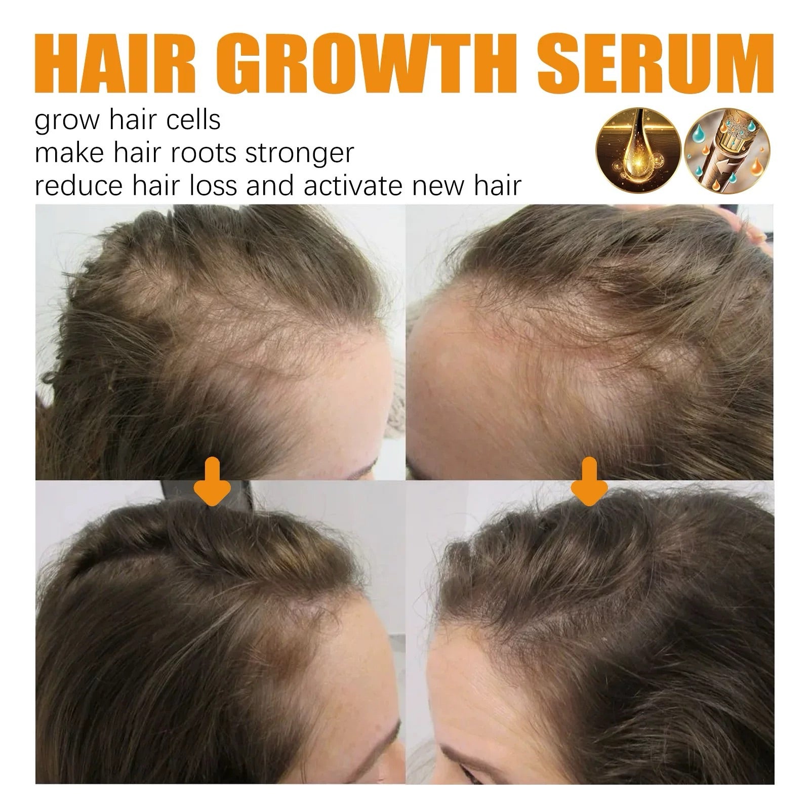 1+1 Kostenlos|LushLocks™ – Für dichteres, kräftigeres Haar in nur wenigen Wochen
