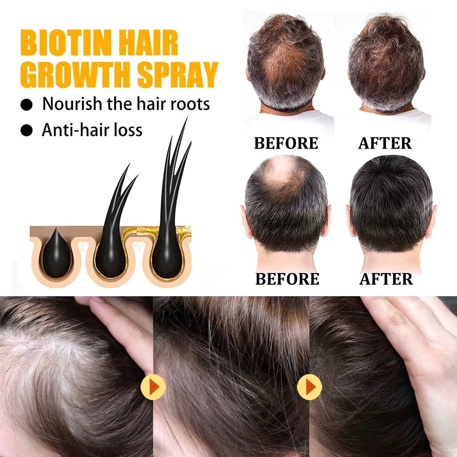 1+1 Kostenlos|LushLocks™ – Für dichteres, kräftigeres Haar in nur wenigen Wochen